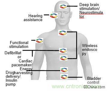 植入无线电应用示例