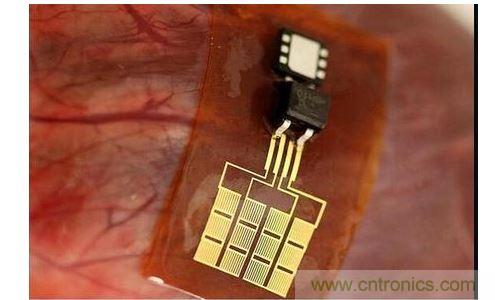 可将人体变成电脑的电子皮肤！