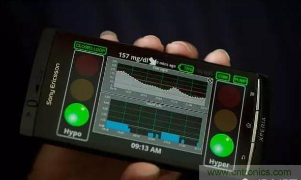 这些新&ldquo;上线&rdquo;的智能医疗设备，真的实用吗？