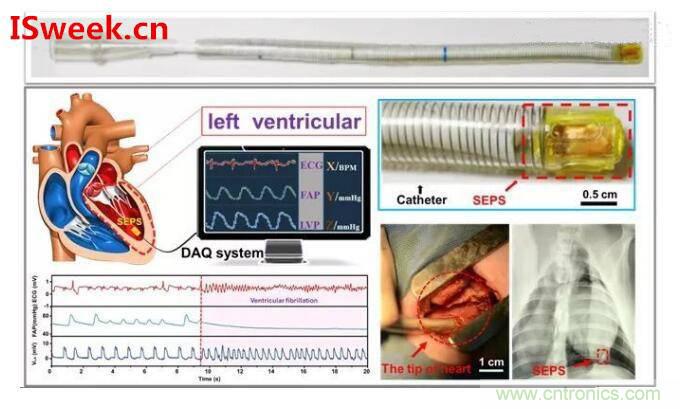 详解光纤压力传感器在心内压评估的应用 详解光纤压力传感器在心内压评估的应用
