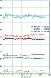 你知道吗？原来耳朵才是测心率的最佳位置