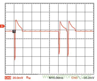 检测并区分心脏起搏伪像