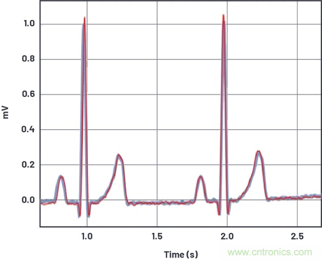 可穿戴市场喜迎生物医学“多面手”