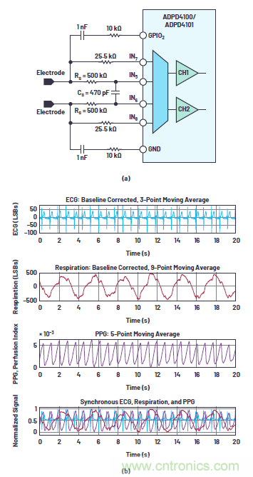多参数生命体征监测比以往任何时候都更容易