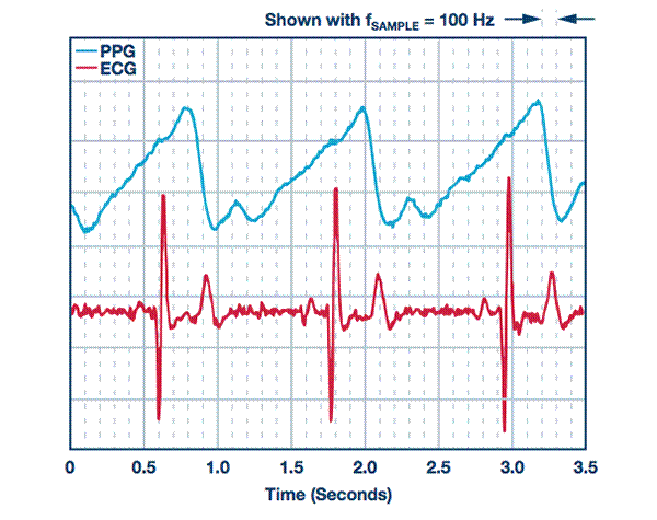 从可穿戴设备过渡到医疗设备
