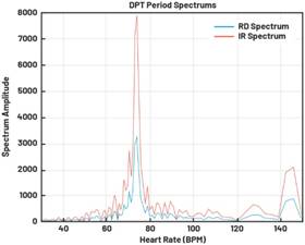 动态离散周期变换技术突破：无ECG参考的生理信号精准解析
