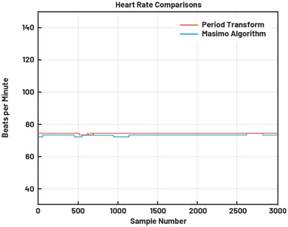 动态离散周期变换技术突破：无ECG参考的生理信号精准解析