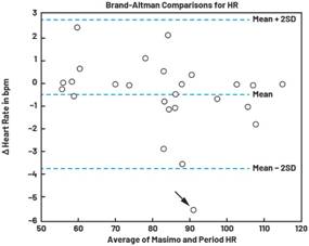 动态离散周期变换技术突破：无ECG参考的生理信号精准解析