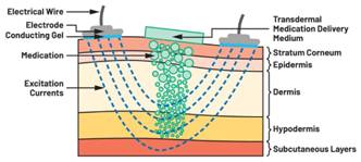  图5.人体皮肤分层横截面以及TMD和生物阻抗测量  考虑到生物阻抗分析的无创性，使用两个金属电极代表电气传感器，连接模拟前端(AFE)电路和患者皮肤。这个金属与非金属的接触点是构成整个电路的另一个关键部分，连接了AFE和人体电气模型。电荷载体（电极中的电子和人体内的离子）之间的相互作用可能对这些传感器的性能产生重大影响，需要根据每种应用进行具体考虑。首先，金属与离子溶液接触的相互作用导致金属表面附近溶液中离子浓度的局部变化。这种现象会改变电极下方区域的电荷中性，导致金属周围的电解质电位与溶液其余部分不同，从而在金属和电解质主体之间产生一个电位差，即常说的“半电池电位”。其次，注入电流的直流分量会导致电极极化。  表1.各种电极类型和相应的半电池电位  金属及反应  半电池电位(V)  Al → Al3+ + 3e- Al → Al3+ + 3e-  –1.706 –1.706  Ni → Ni2+ + 2e- Ni → Ni2+ + 2e-  –0.230 -0.230  H2 → 2H+ + 2e- H2 → 2H+ + 2e-  0.000 (by definition) 0.000（根据定义）  Ag + Cl- → AgCl + e- Ag + Cl- → AgCl + e-  +0.223 +0.223  Ag → Ag+ + e- Ag → Ag+ + e-  +0.799 +0.799  Au → Au+ + e- Au → Au+ + e-  +1.680 +1.680  这是一种不良现象，往往导致电极性能下降。这些考量表明，电极也需要定义适当的电气模型（参见图6）。我们可以将干电极表示为具有三个串联元件的电路：一个用于模拟半电池电位(EHC)的直流电源；一个用于模拟金属和非金属（人体）之间接触的RC并联电池(Rd||Cd)；以及一个用于模拟电极金属的电阻Rs。